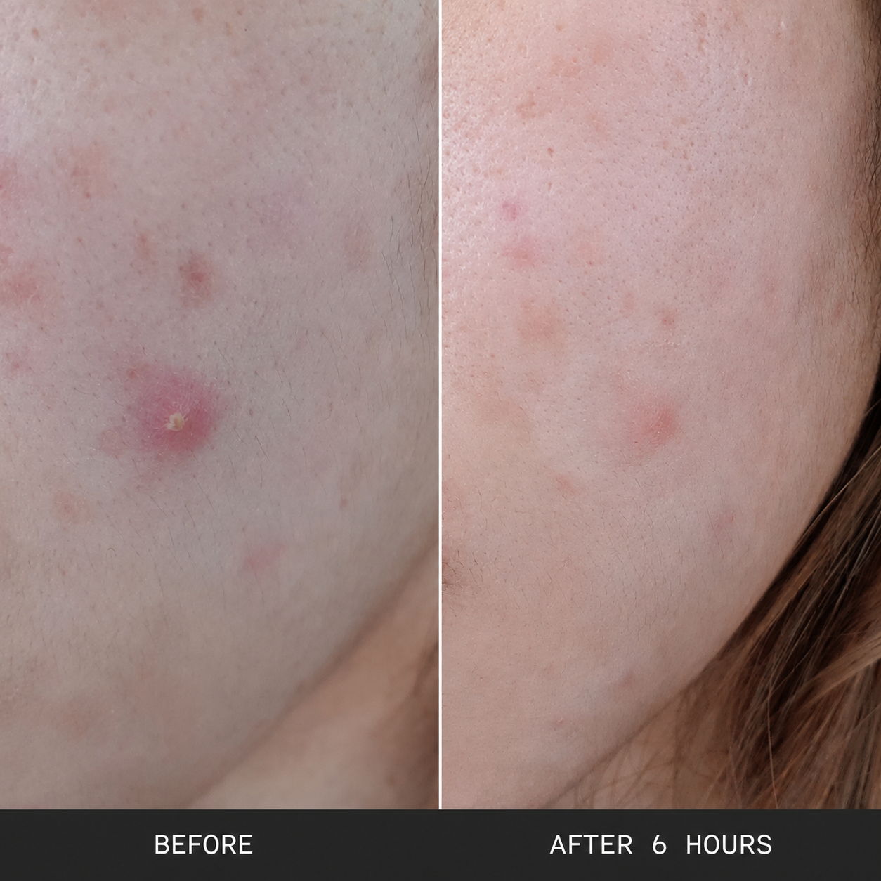 Haloskin 90-Day Clear Skin Kit