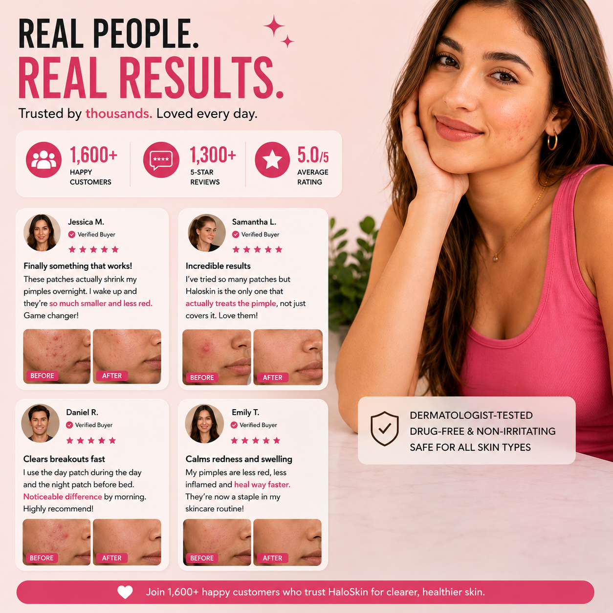 Haloskin 90-Day Clear Skin Kit