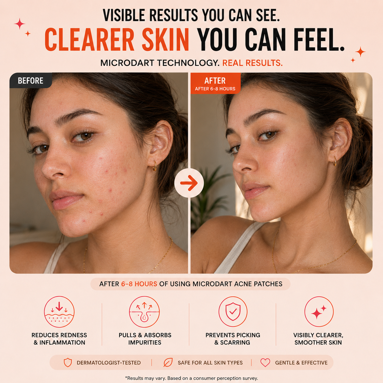 Acne Control Combo