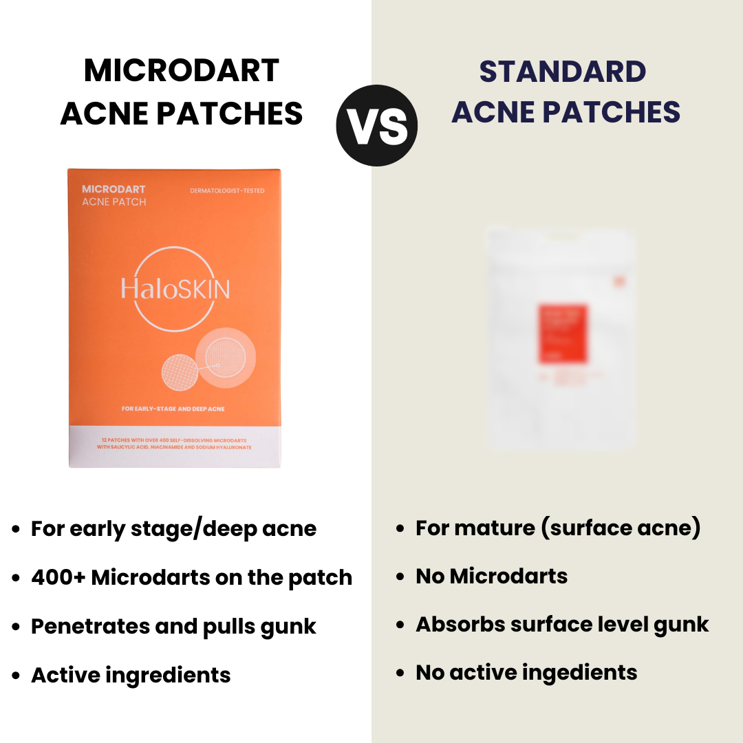 Total Acne Control Kit