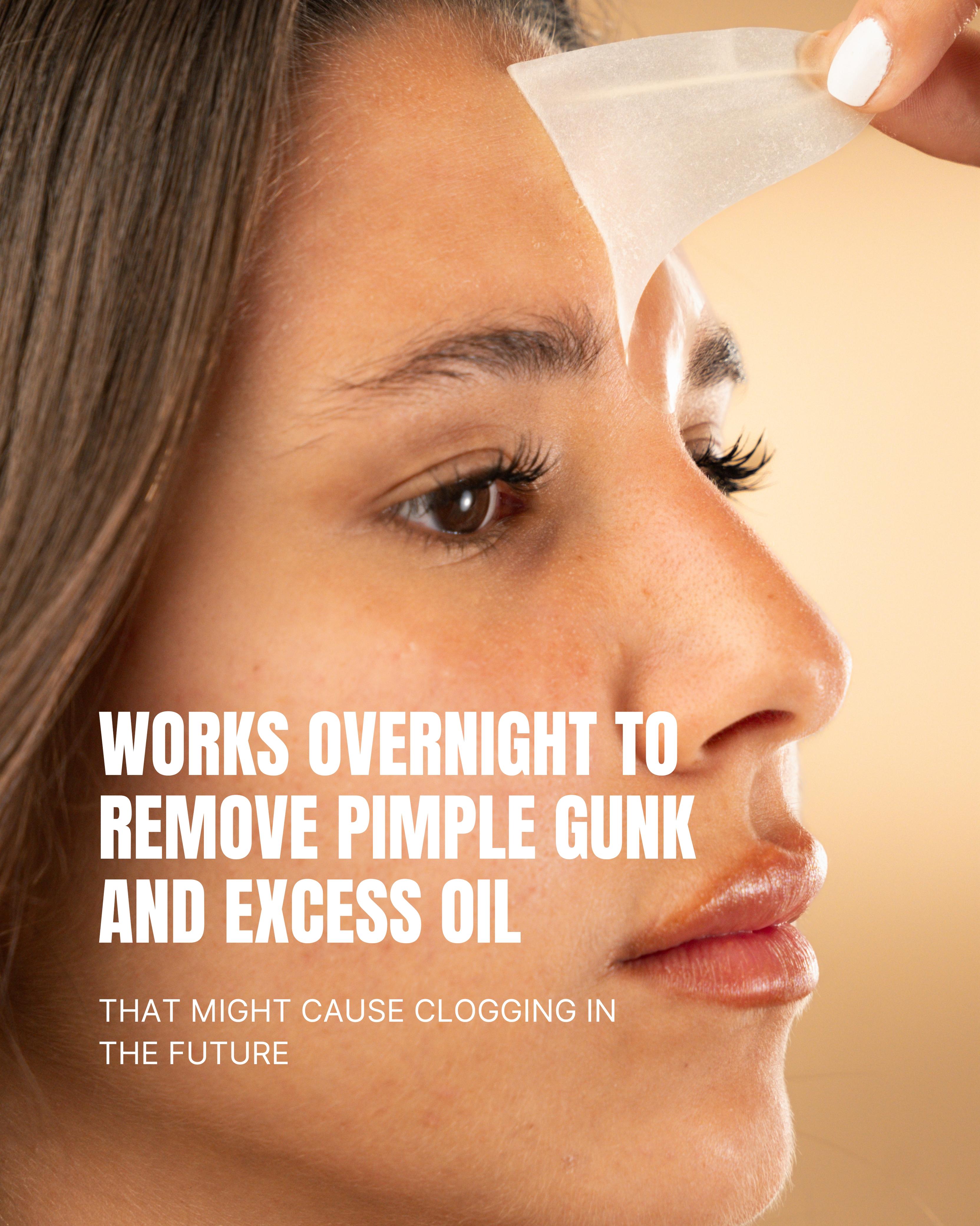 Acne Spot Treatment Duo Bundle