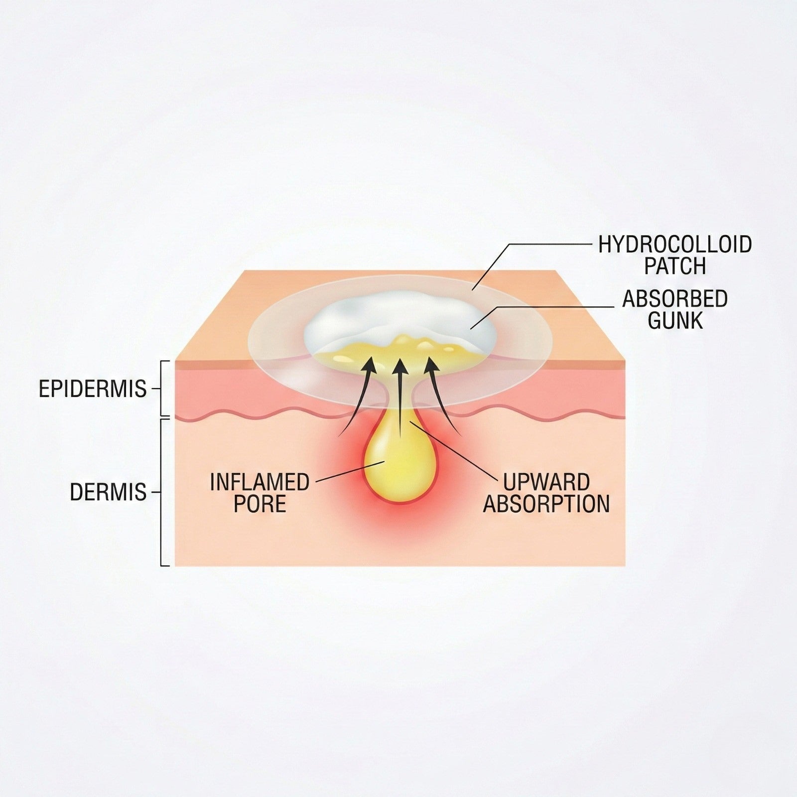 Day & Night Acne Patches