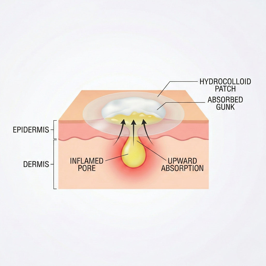 Day & Night Acne Patches