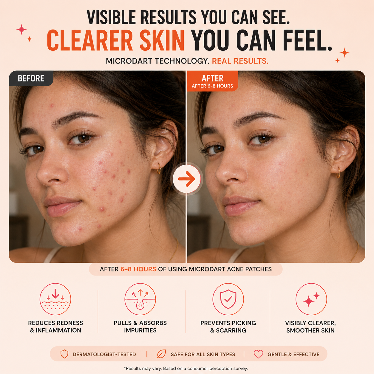 Acne Control Combo