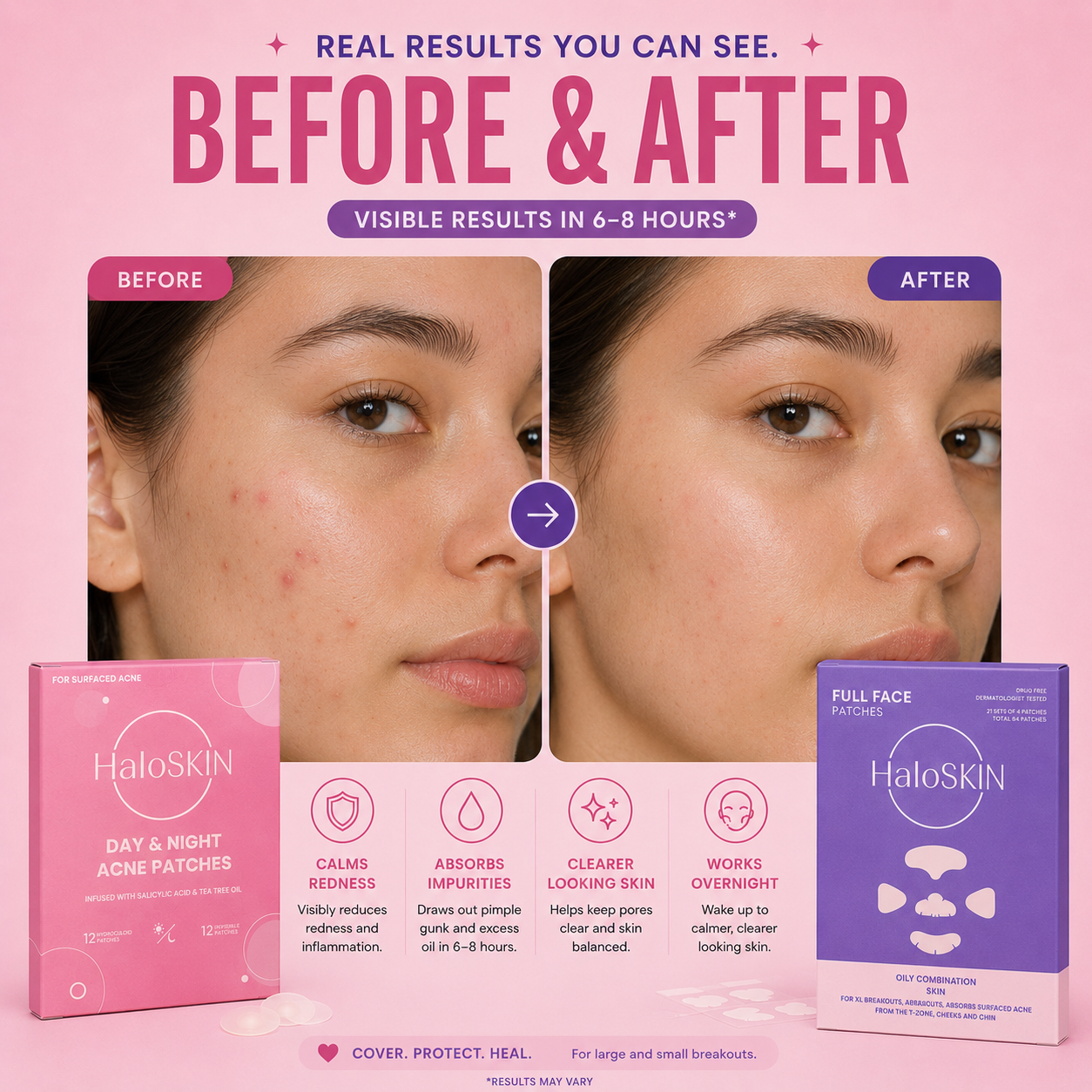 Acne Spot Treatment Duo Bundle
