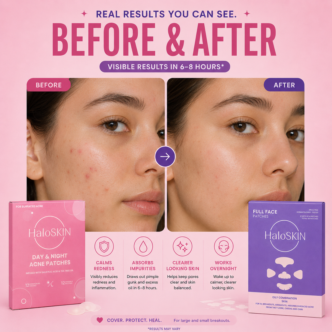 Acne Spot Treatment Duo Bundle