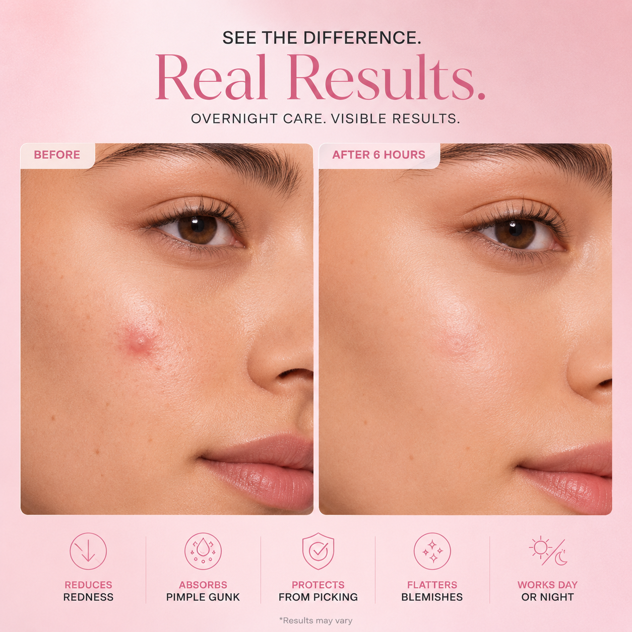 Day & Night Acne Patches