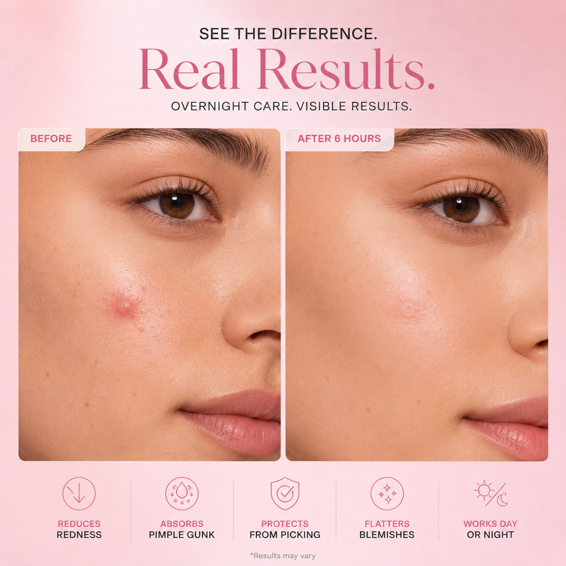Day & Night Acne Patches