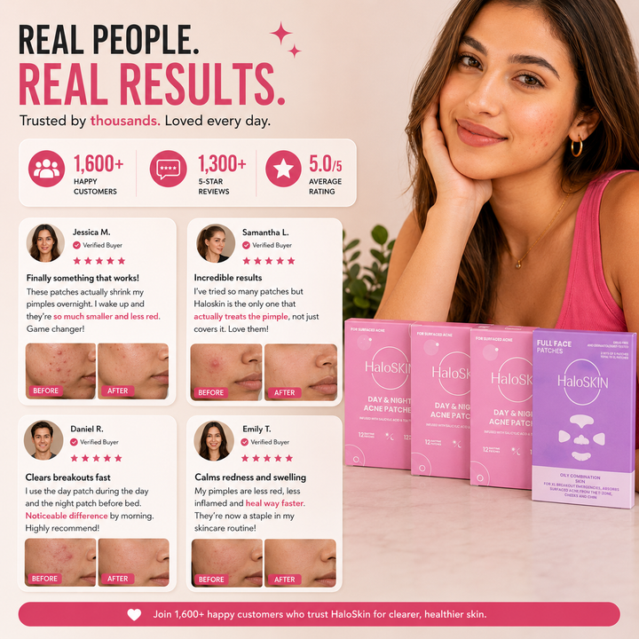 Haloskin 90-Day Clear Skin Kit